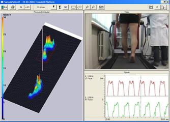 压力分布测量及步态分析跑台
